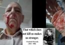 Video & Audio: That which does not KILL YOU, makes you stronger – My Recent Accident
