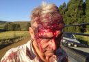 5 Photos: South Africa: A Boer Farmer and his son almost beaten to death by his Black workers